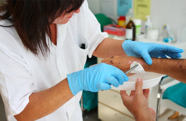 Wundversorgung beim Pflegedienst Aurelia in Bad Boll